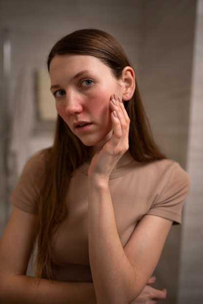 Популярные методы лечения красных пятен на лице