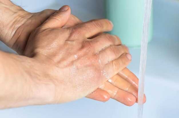 Выбор мази для лечения дерматита на руках