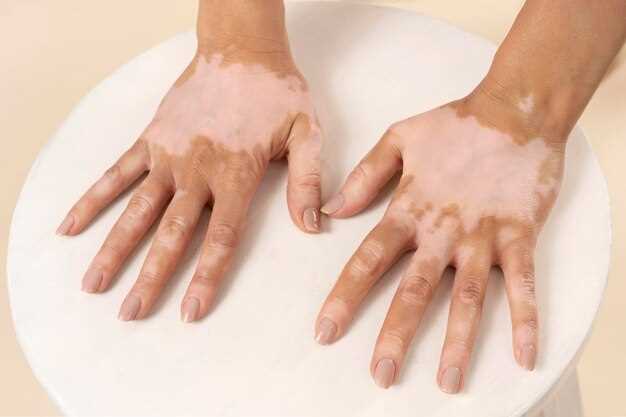 Причины появления белых пятен на ногтях на руках