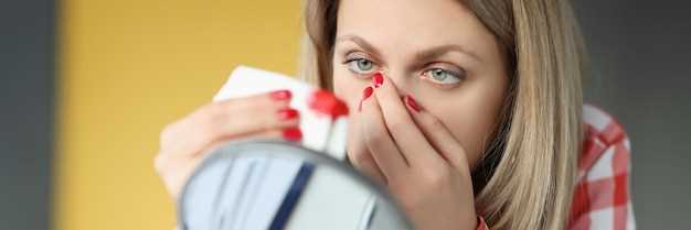 Что делать при длительной крови из носа