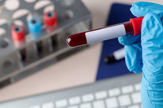 Как происходит анализ лейкоцитарной формулы крови?