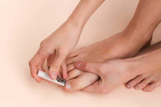 Причины отхождения ногтя на большом пальце ноги