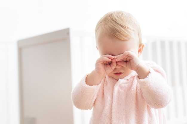 Причины появления желтых белков глаз у новорожденных