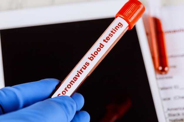 Биохимический анализ крови: значение определения уровня тбилирубина