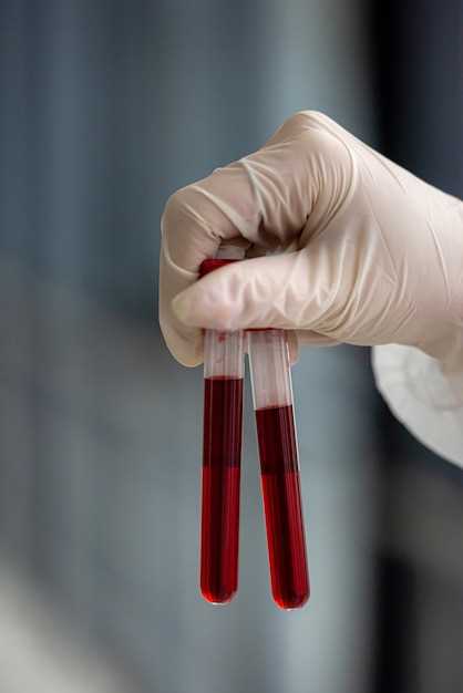 Что такое вязкость крови и как она обозначается в анализах?